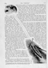 Thumbnail 0036 of St. Nicholas. June 1893